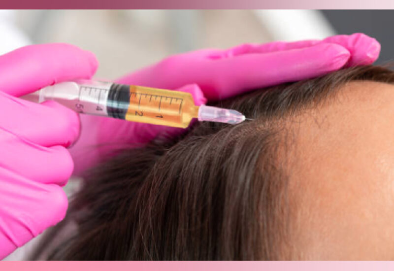 PRP / PRF & Hair Restoration – beautyfusionaesthetics