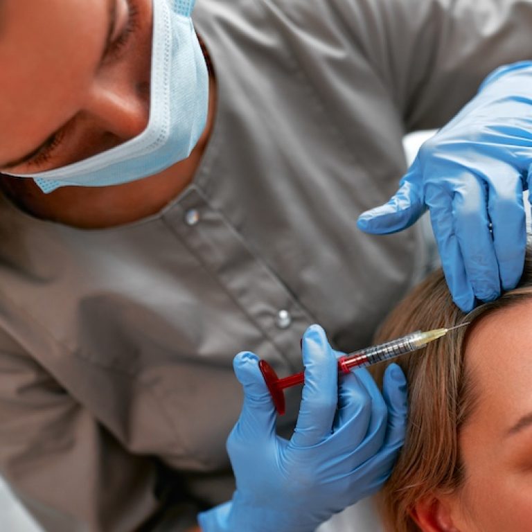 Mesotherapy, vitamin injections in head skin of hair area. Professional hair loss treatment. Close up view of woman head and doctor's hands with syringe.